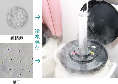 生殖医療3