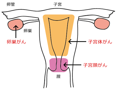 gynecology01