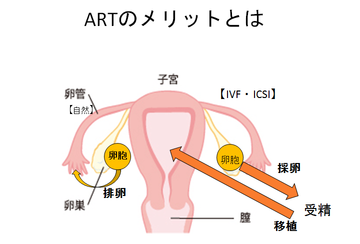 生殖補助医療（ART） | 山口県済生会下関総合病院